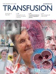 TRANSFUSION