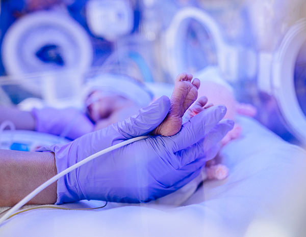Neonate